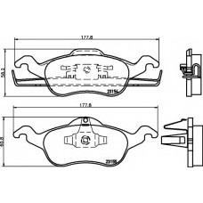 Колодки гальмівні (передні) Ford Focus 99-09 (Teves) Q+